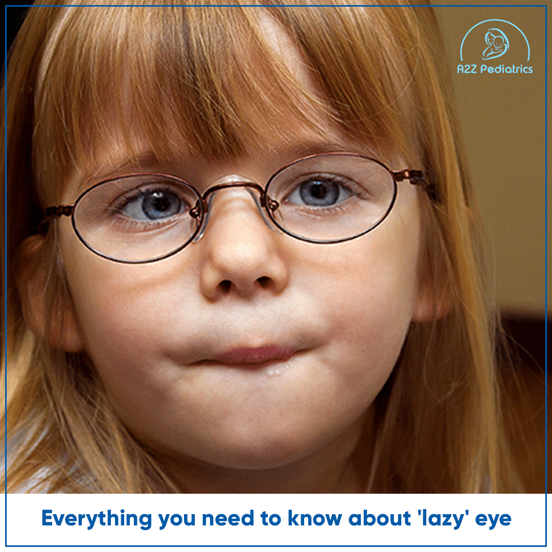 Everything you need to know about lazy eye
